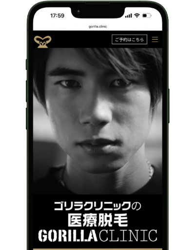 ゴリラクリニックメンズ脱毛のLP